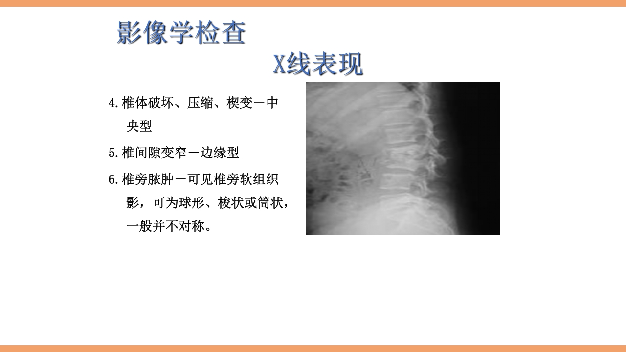 脊柱结核的护理PPT课件下载25