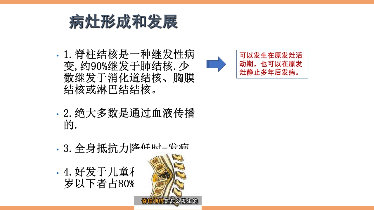 脊柱结核的护理PPT课件下载5
