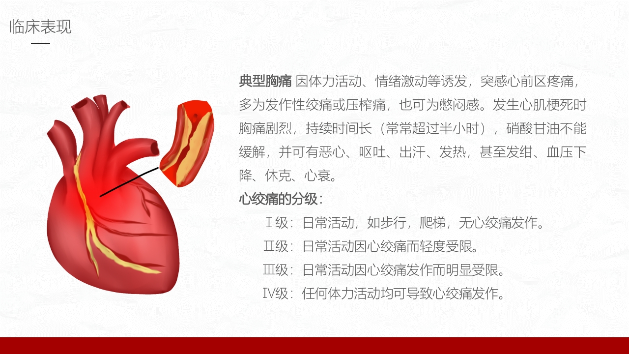 冠心病的护理业务学习课件PPT下载件8