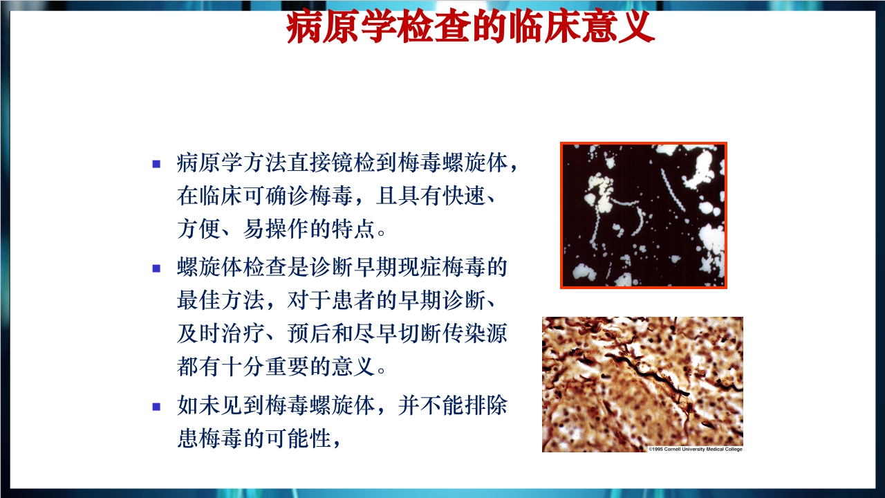 梅毒实验室诊断技术及梅毒实验室检测技术规范简介PPT课件14