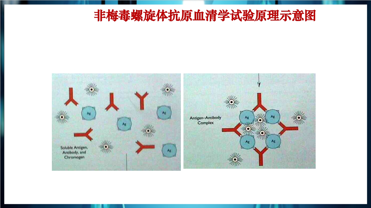 梅毒实验室诊断技术及梅毒实验室检测技术规范简介PPT课件21