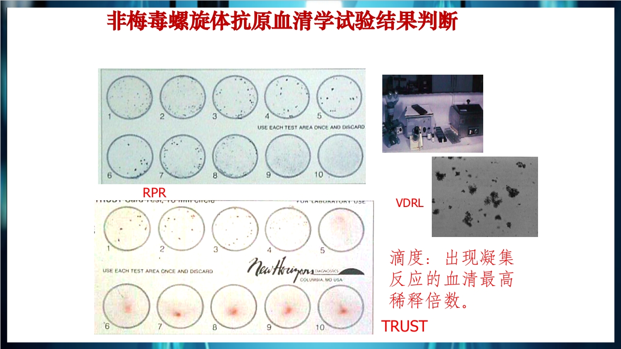 梅毒实验室诊断技术及梅毒实验室检测技术规范简介PPT课件23