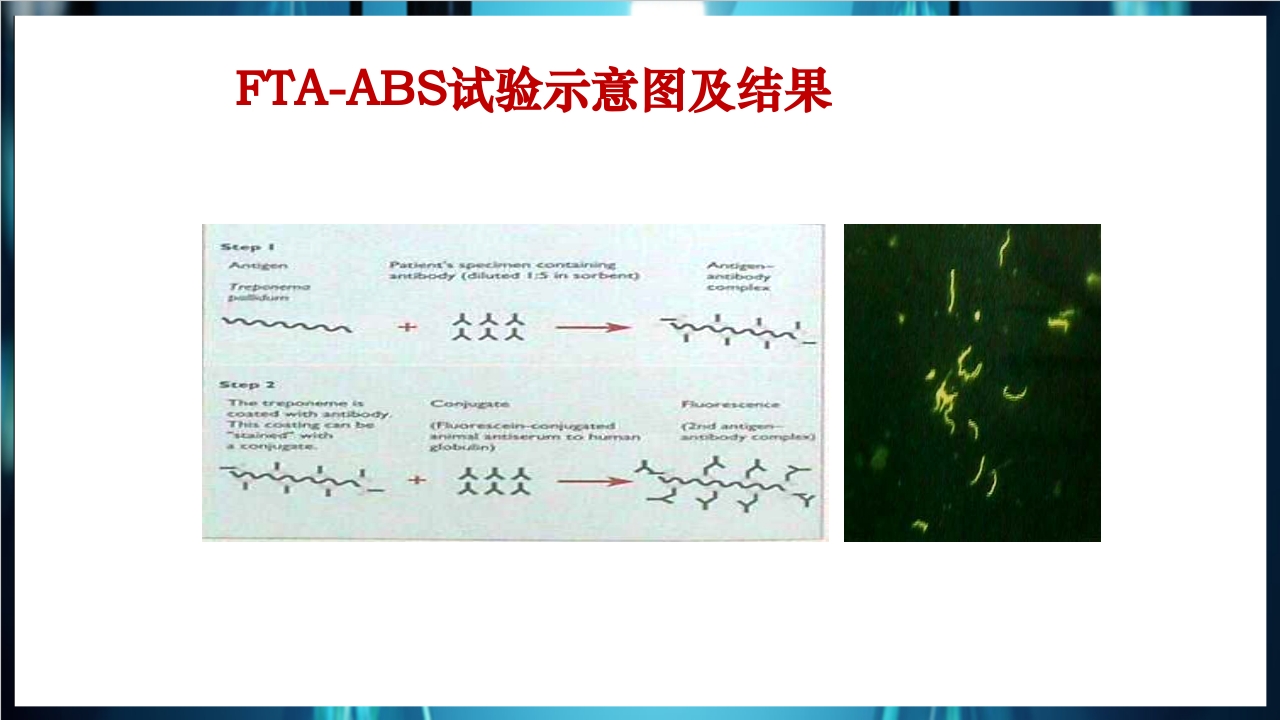 梅毒实验室诊断技术及梅毒实验室检测技术规范简介PPT课件40