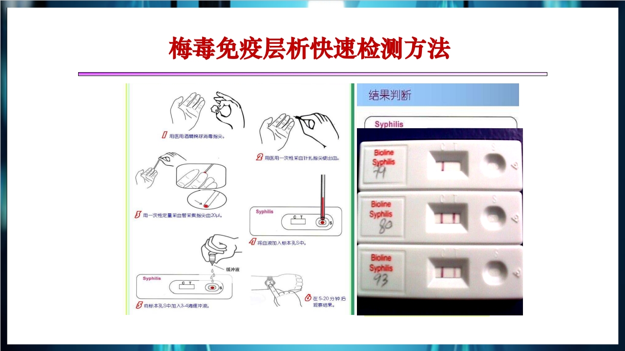 梅毒实验室诊断技术及梅毒实验室检测技术规范简介PPT课件42