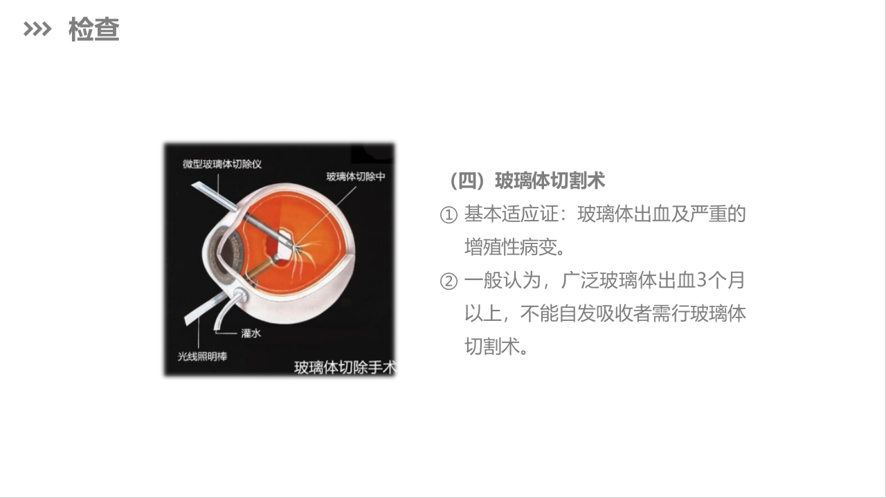 糖尿病视网膜病变护理查房PPT课件下载15