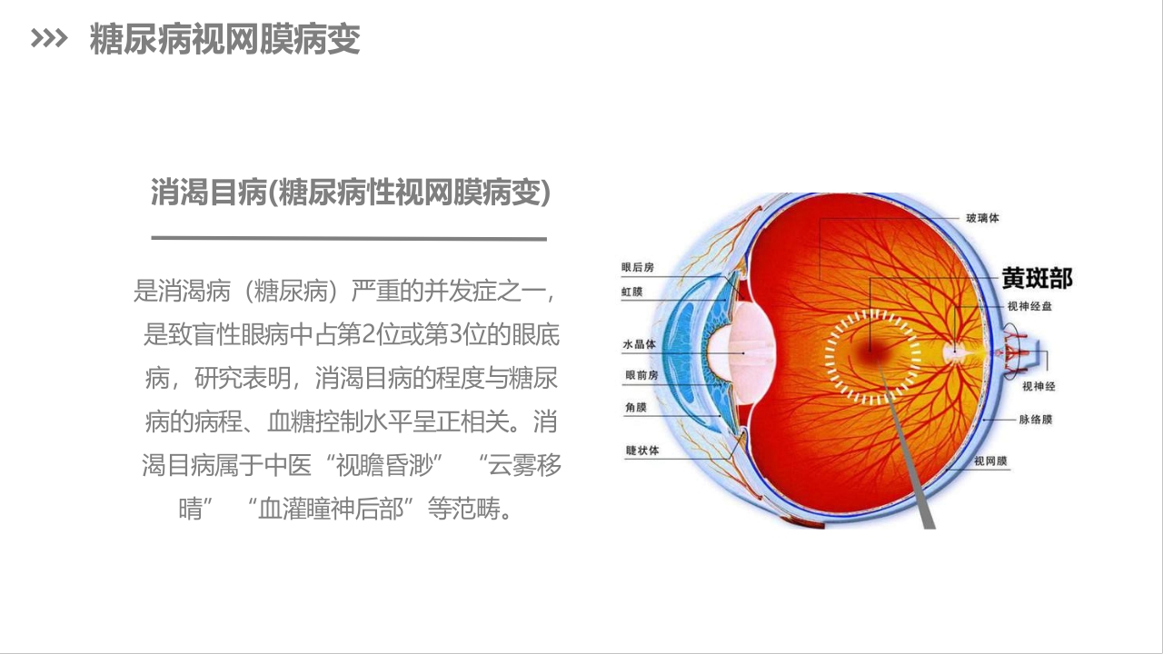 糖尿病视网膜病变护理查房PPT课件下载4