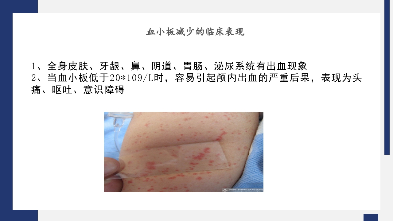 骨髓抑制护理PPT课件9