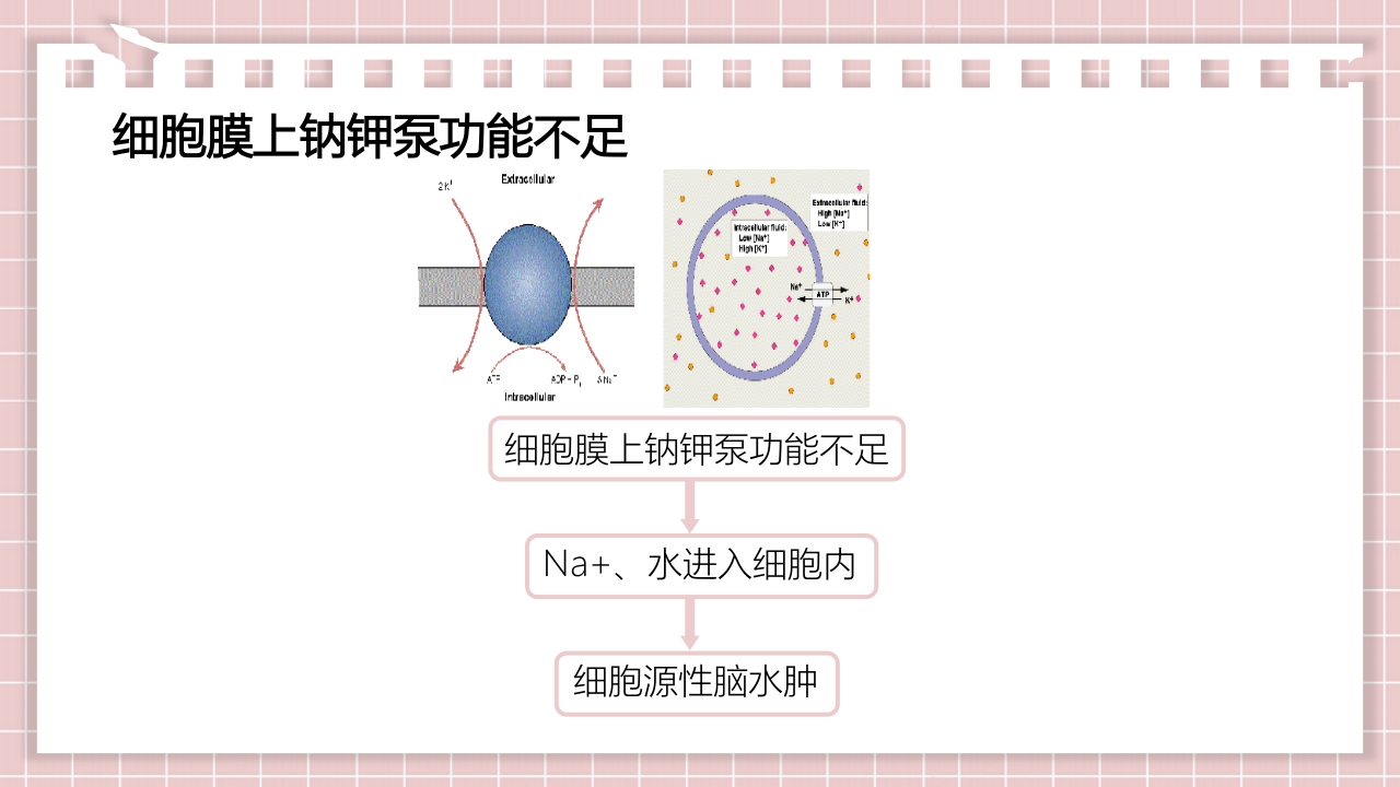 新生儿缺氧缺血性脑病PPT课件15