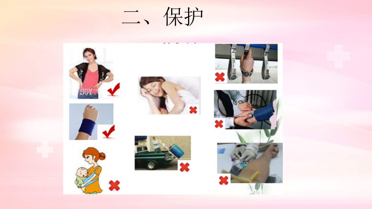 动静脉内瘘的手术配合护理PPT课件19