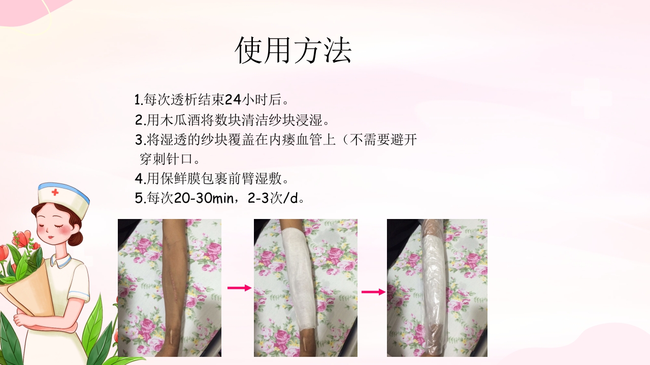 动静脉内瘘的手术配合护理PPT课件29