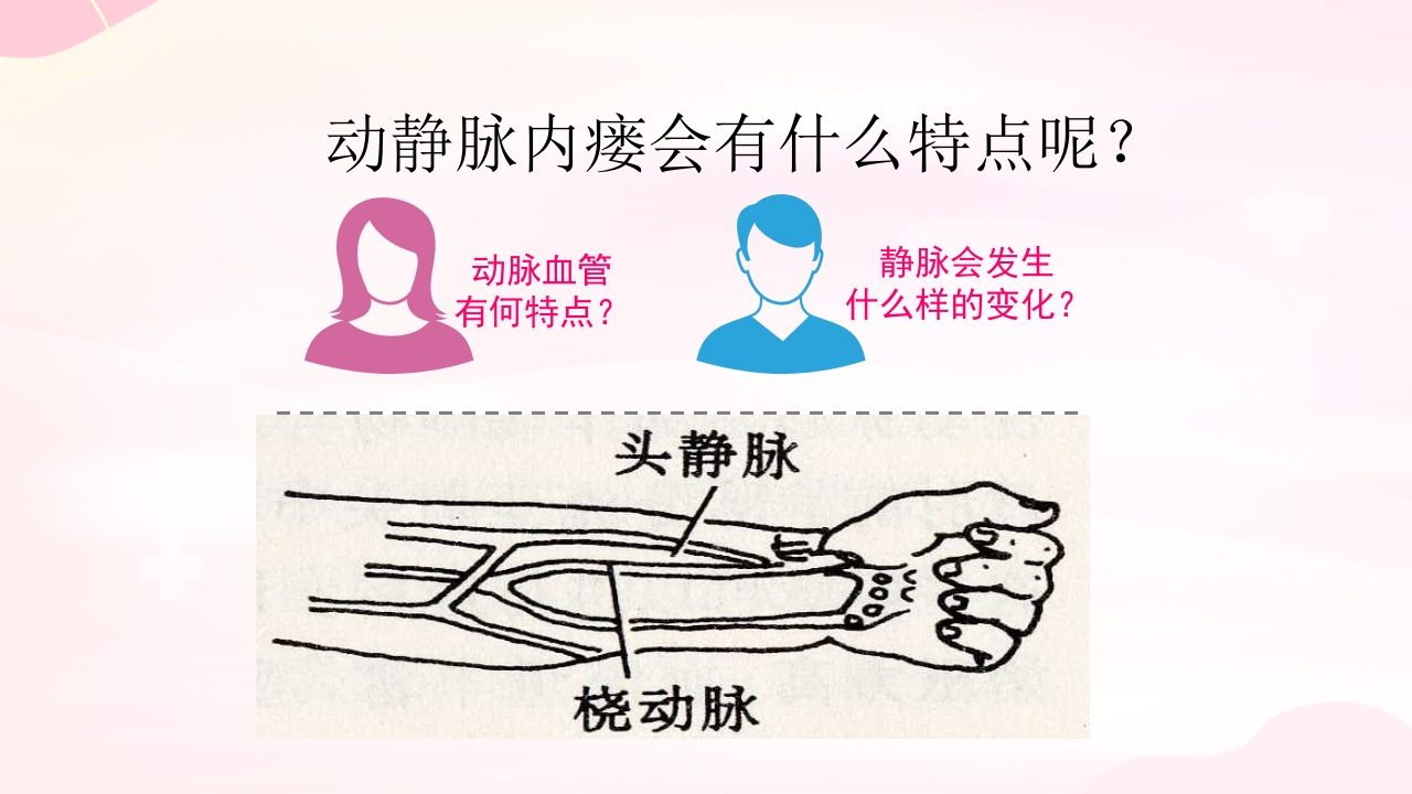 动静脉内瘘的手术配合护理PPT课件4