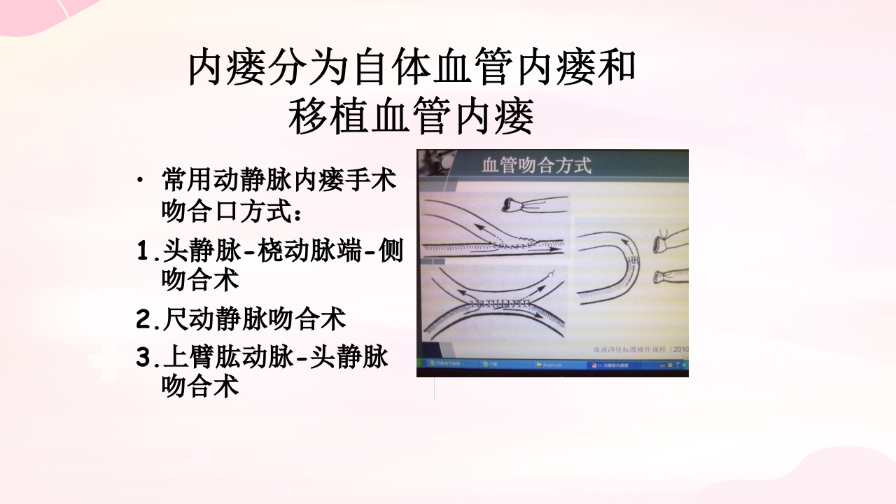 动静脉内瘘的手术配合护理PPT课件7