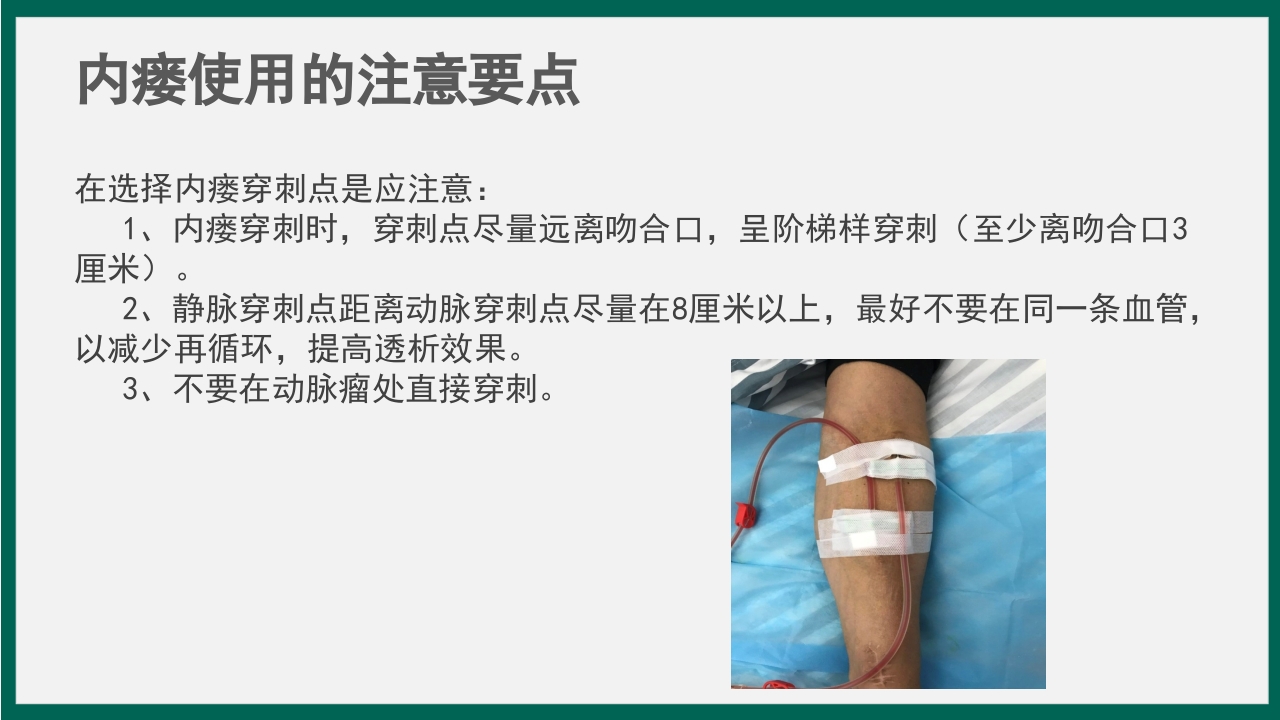 血透患者动静脉内瘘的护理PPT课件7