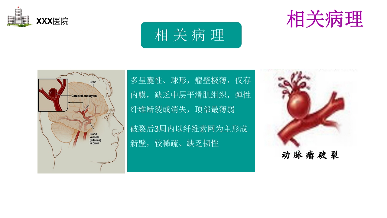 颅内动脉瘤护理查房PPT课件13