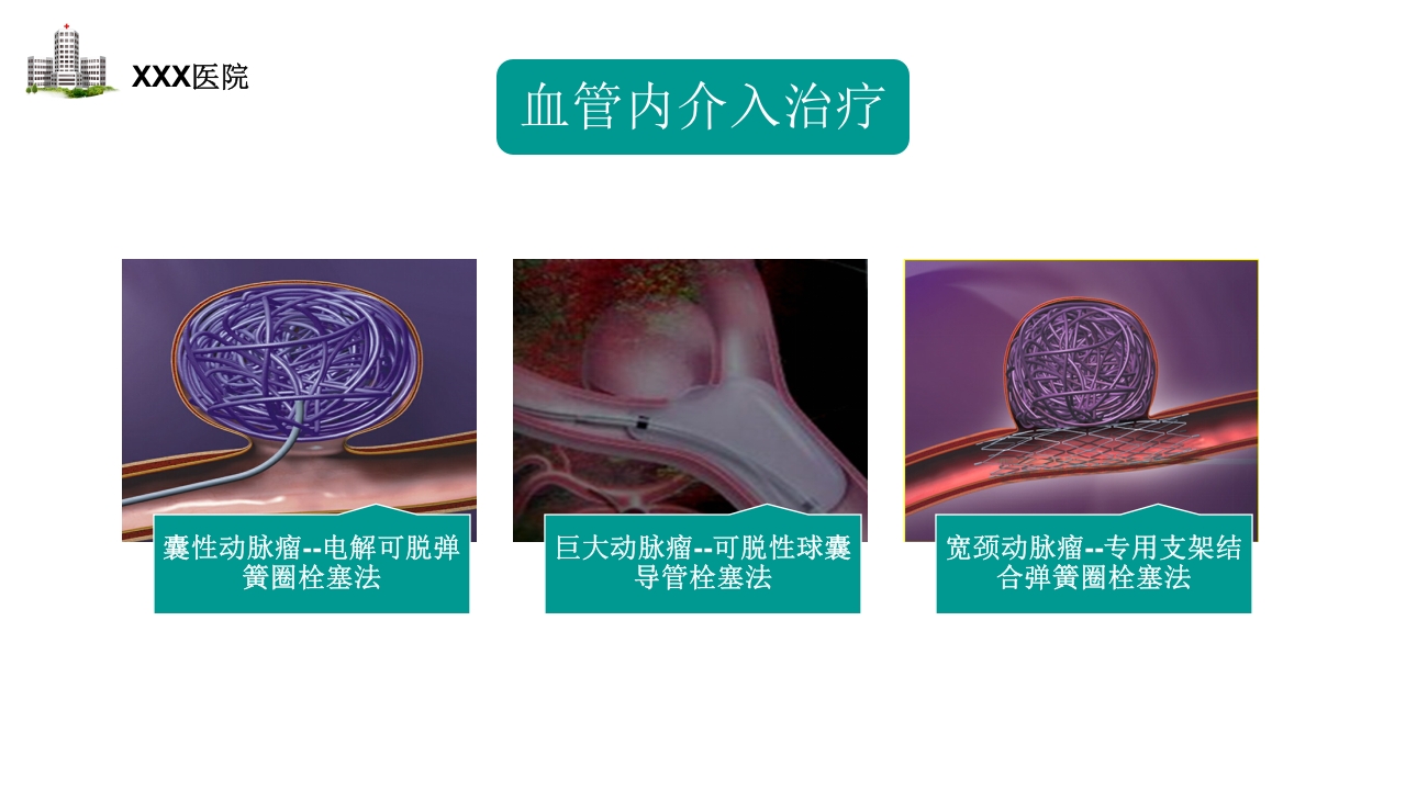 颅内动脉瘤护理查房PPT课件24