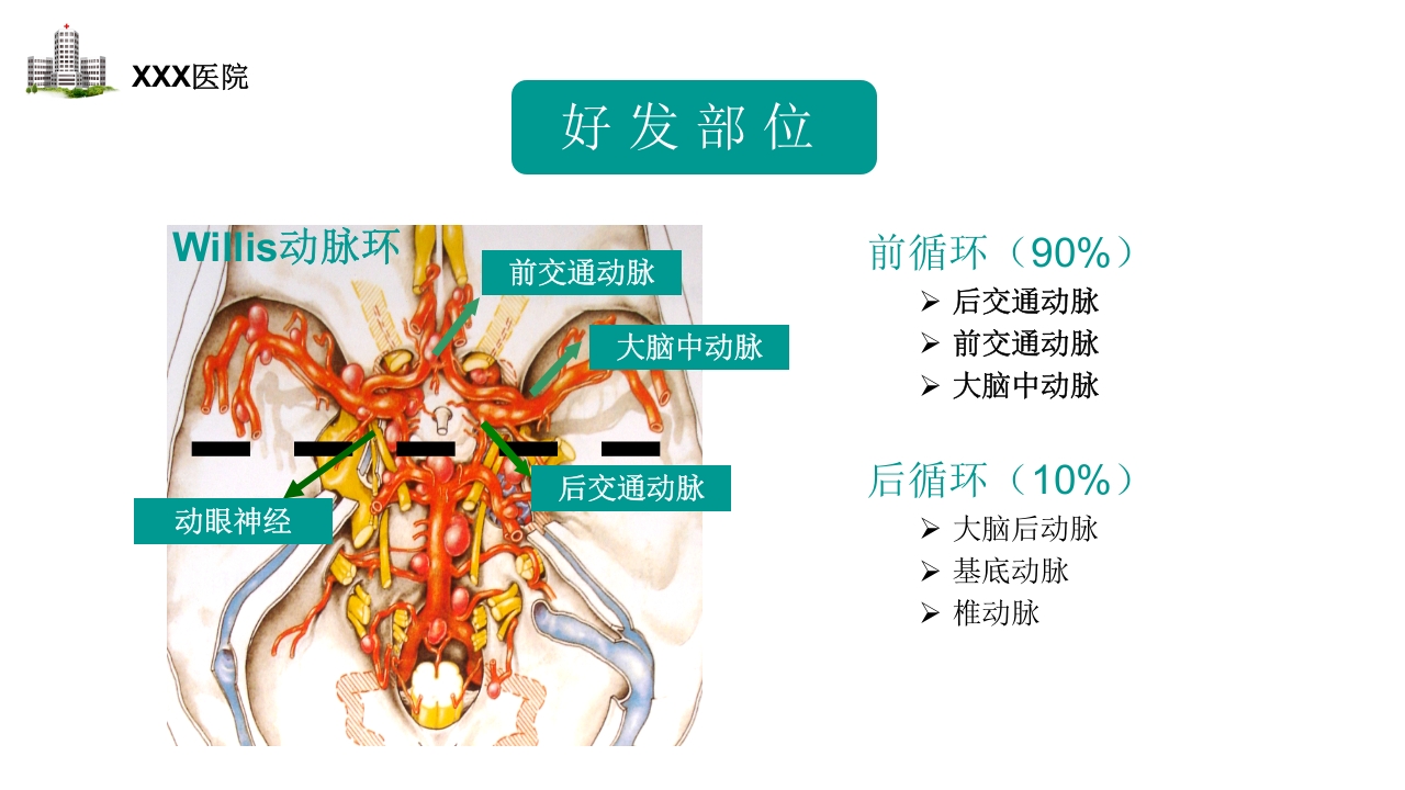 颅内动脉瘤护理查房PPT课件8