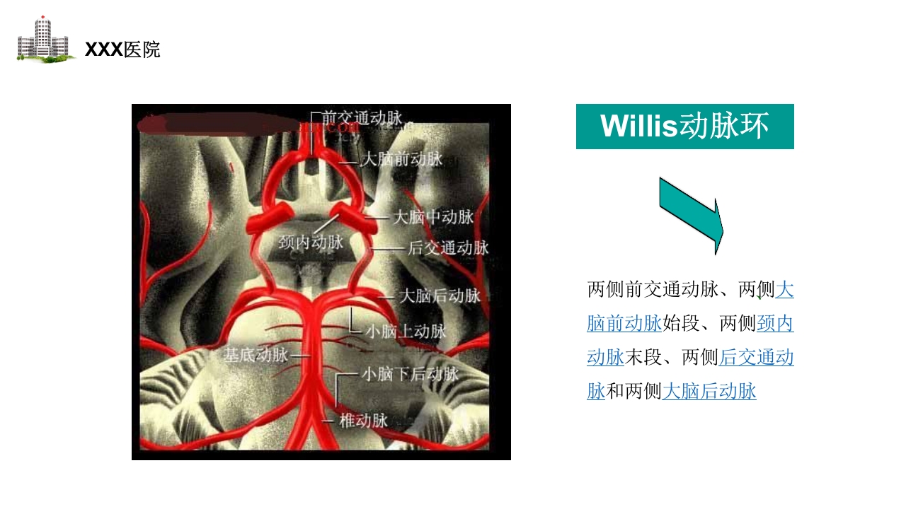 颅内动脉瘤护理查房PPT课件9