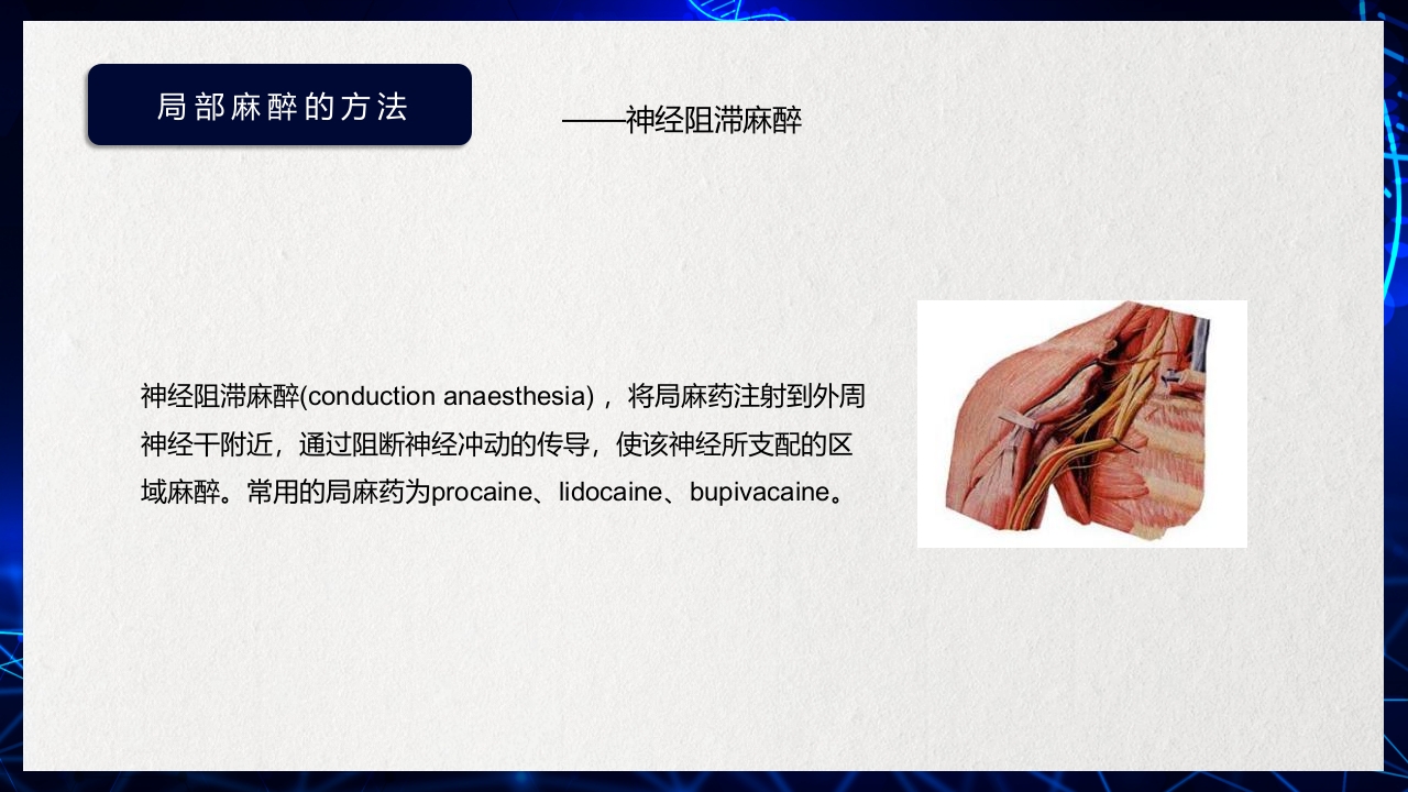 医疗医药局部麻醉概述PPT课件下载20