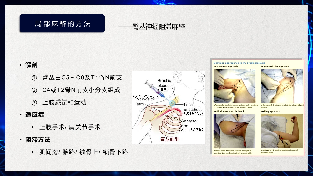 医疗医药局部麻醉概述PPT课件下载23