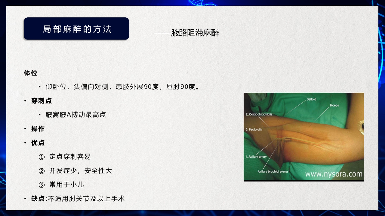 医疗医药局部麻醉概述PPT课件下载28