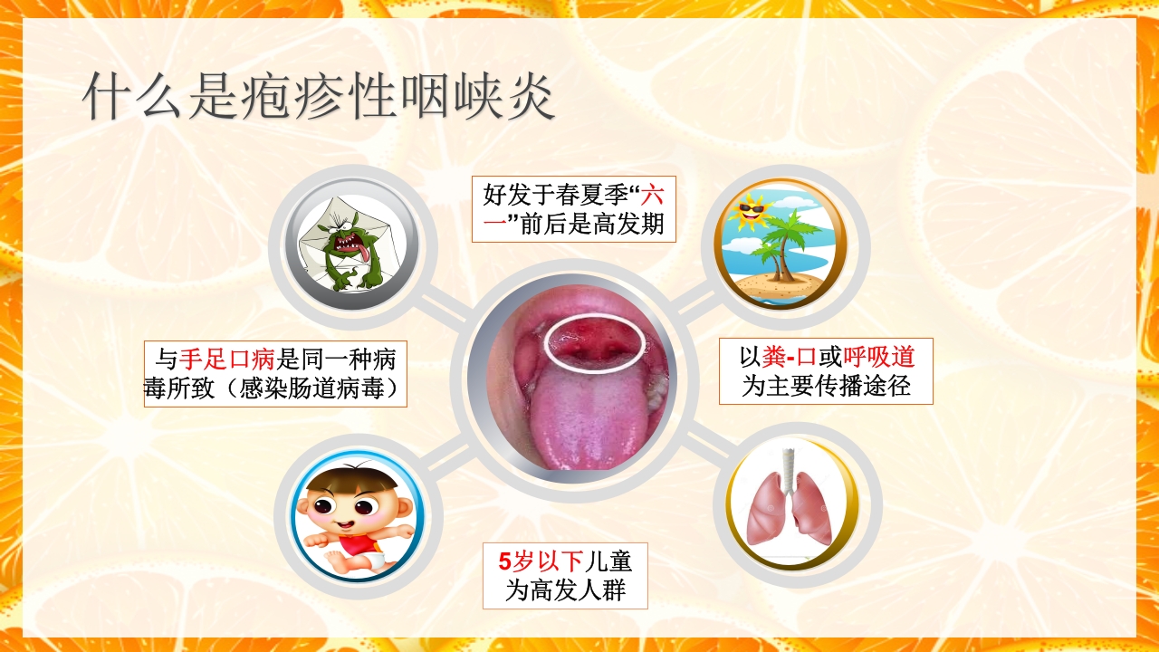 疱疹性咽峡炎的护理PPT课件下载3