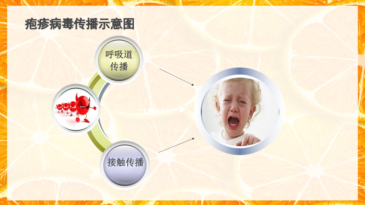 疱疹性咽峡炎的护理PPT课件下载6
