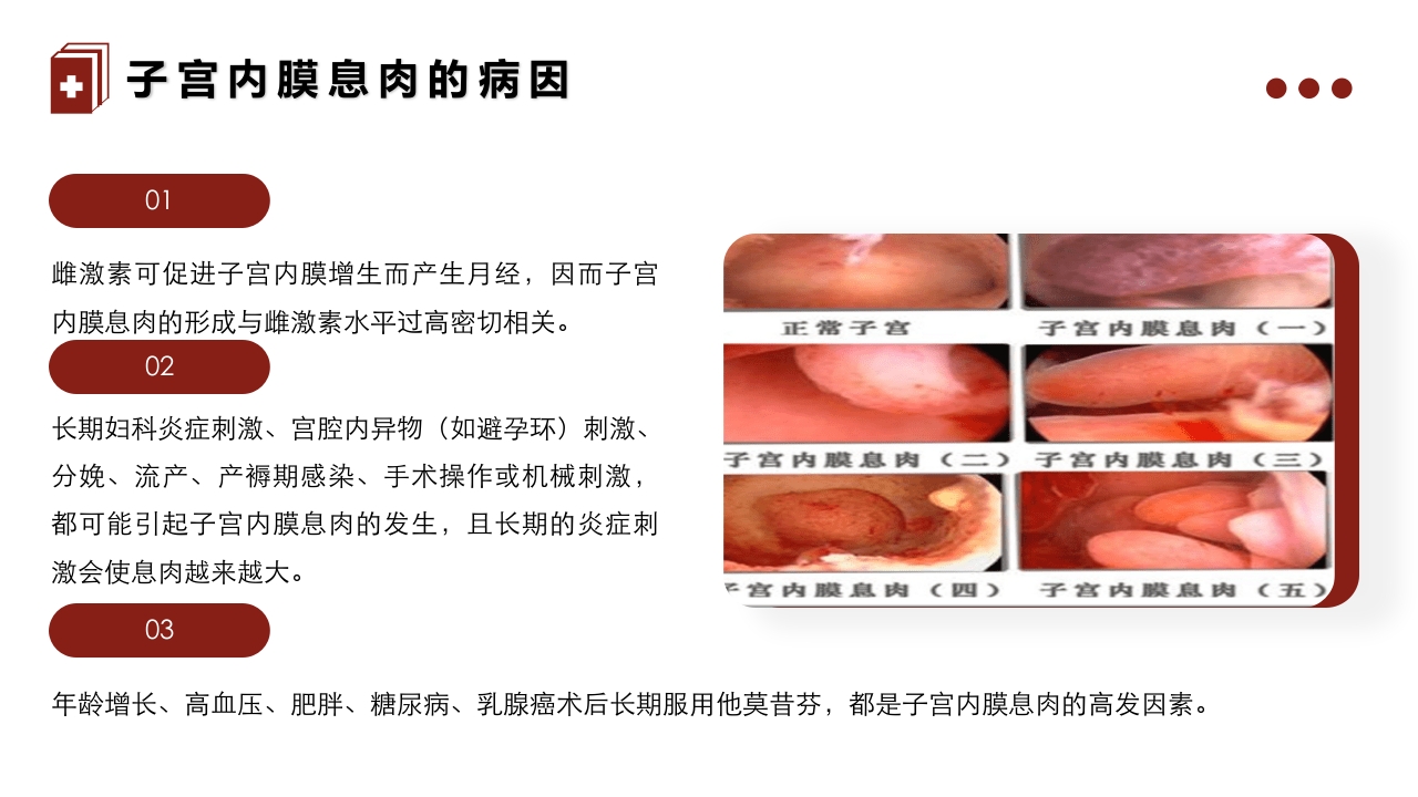 妇科疾病·子宫内膜息肉的护理PPT课件5