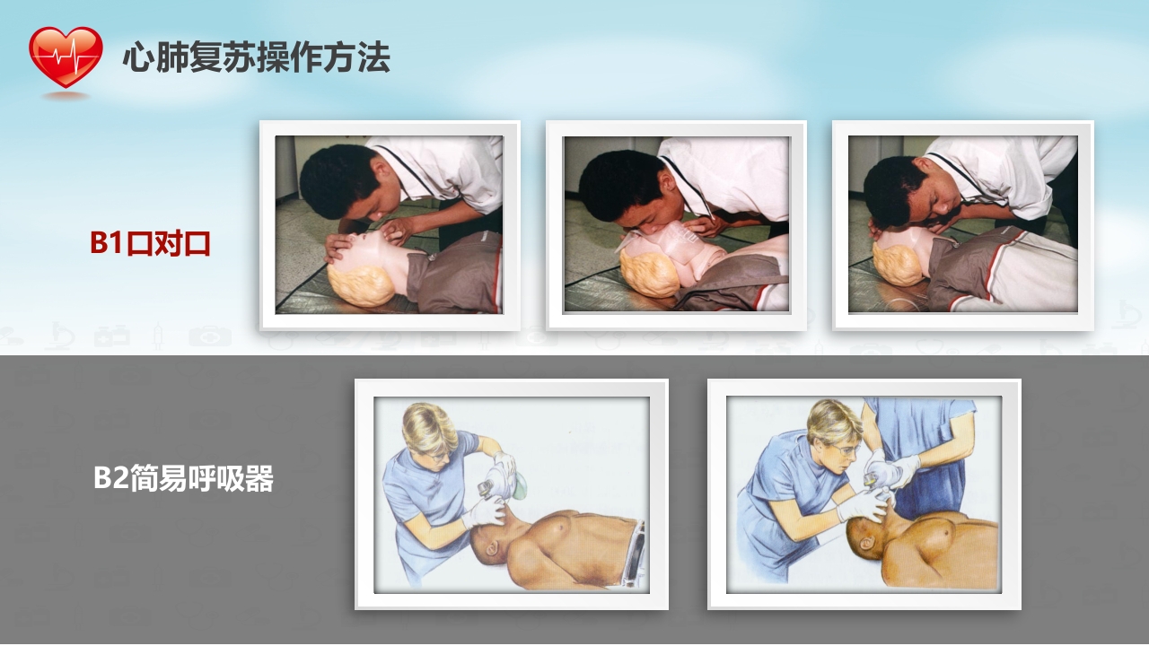 心肺复苏医疗医药PPT25