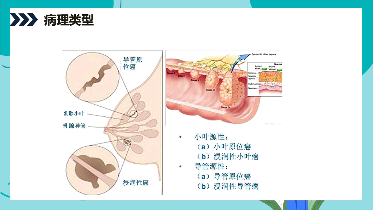 乳腺癌患者术后护理查房PPT课件7