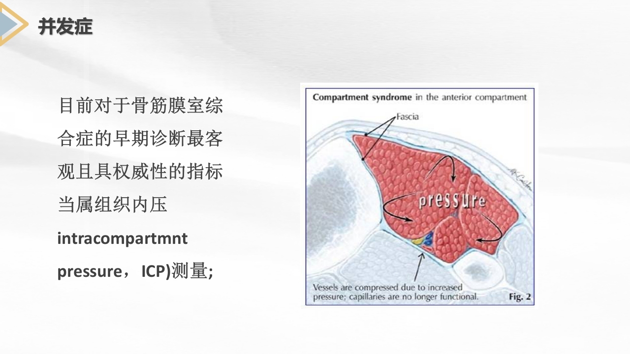 胫腓骨骨折护理查房PPT课件12
