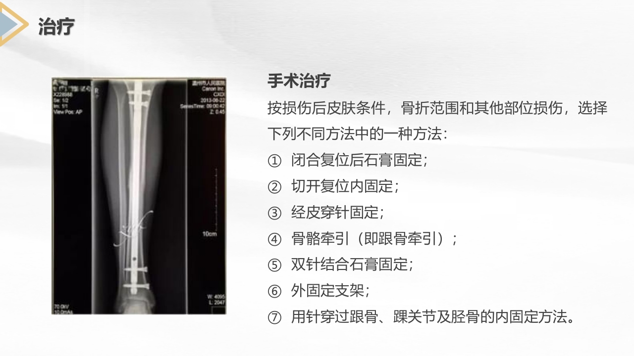 胫腓骨骨折护理查房PPT课件15