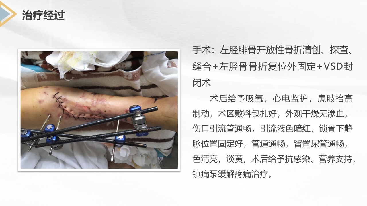 胫腓骨骨折护理查房PPT课件24