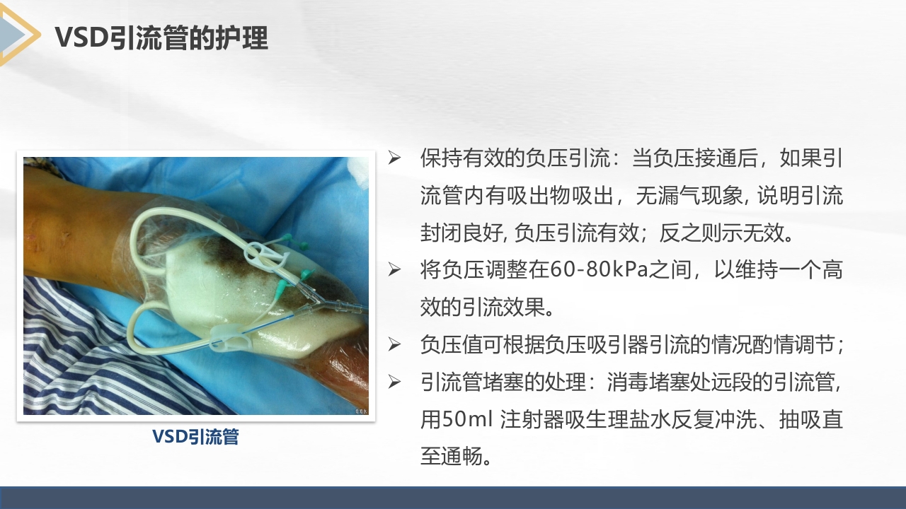 胫腓骨骨折护理查房PPT课件33