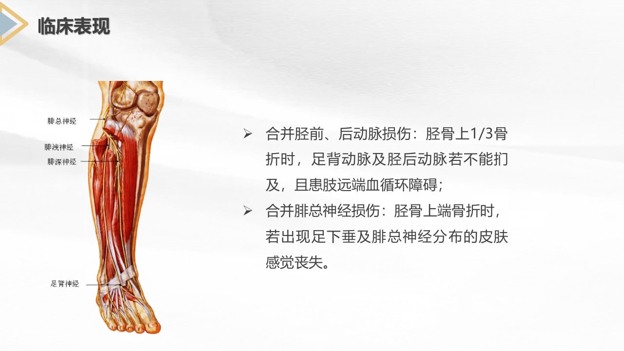 胫腓骨骨折护理查房PPT课件8