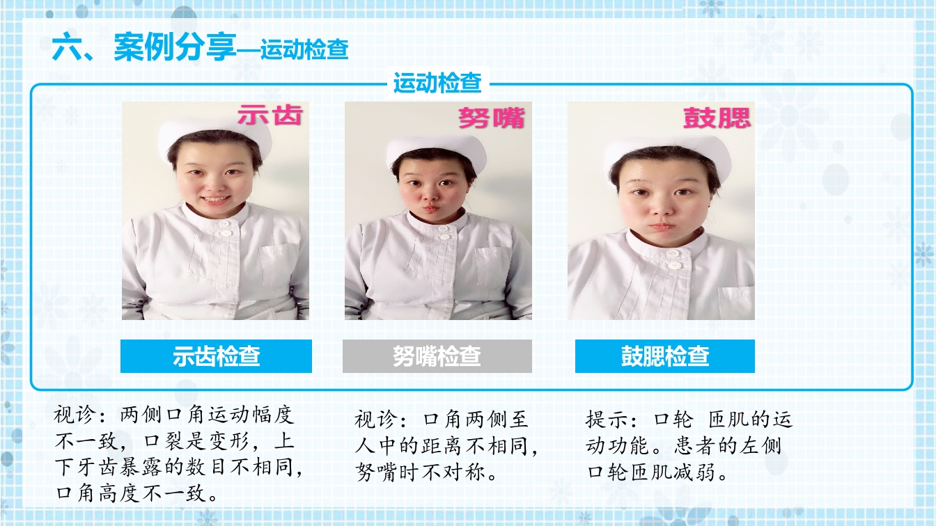 面瘫病人的护理PPT课件14