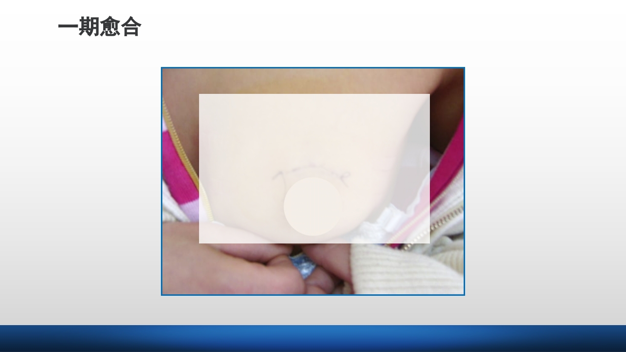 外科伤口护理技术PPT课件14