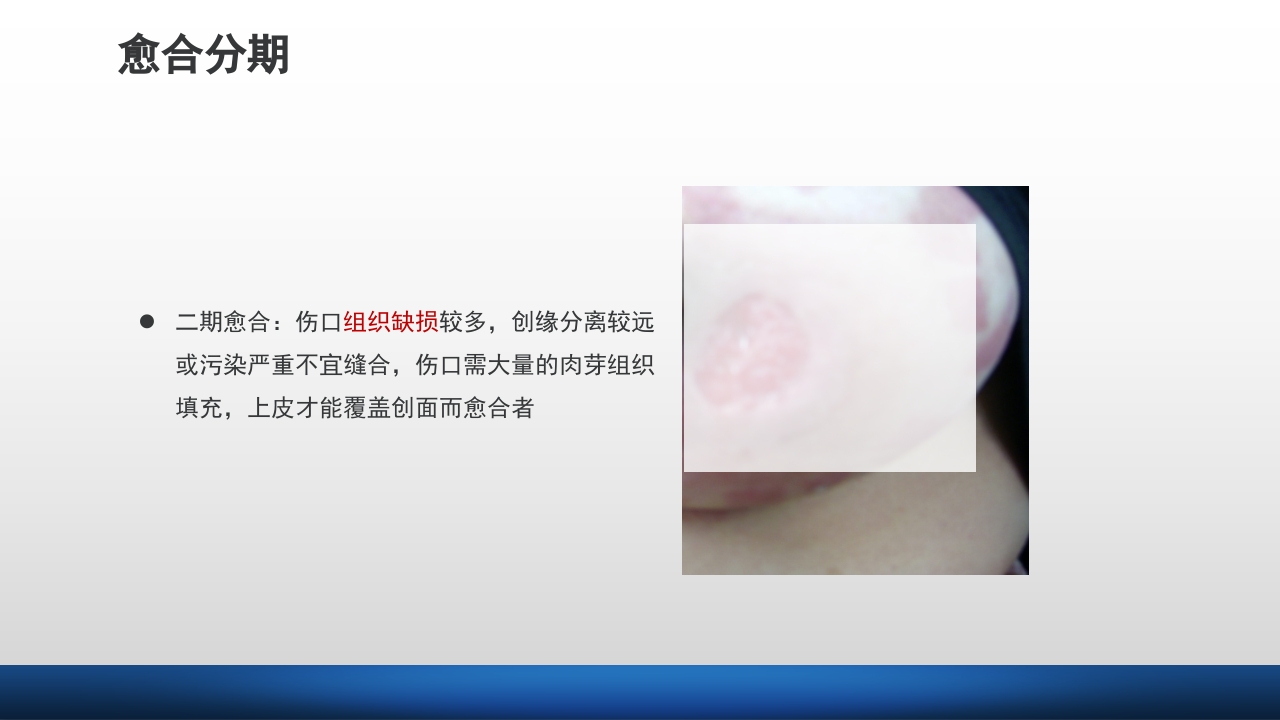 外科伤口护理技术PPT课件15