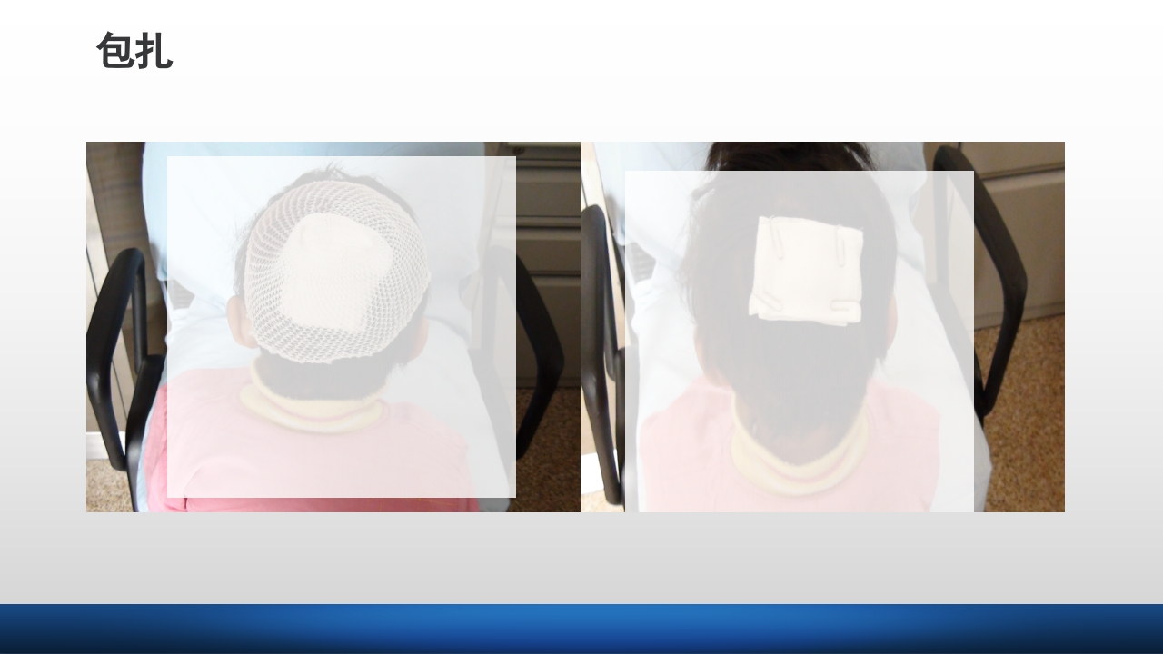 外科伤口护理技术PPT课件64