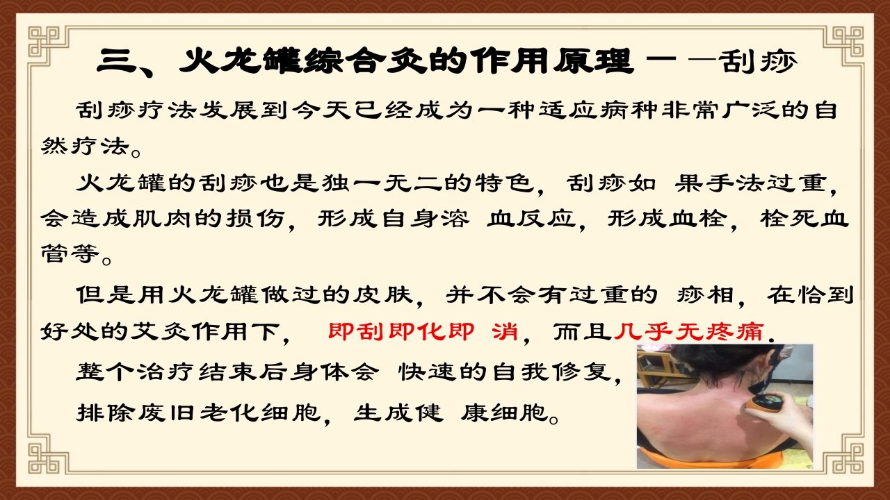 火龙罐综合灸PPT课件下载16