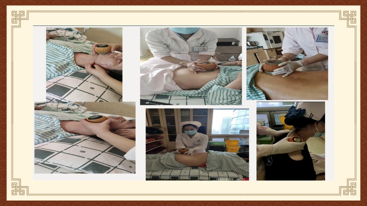 火龙罐综合灸PPT课件下载24