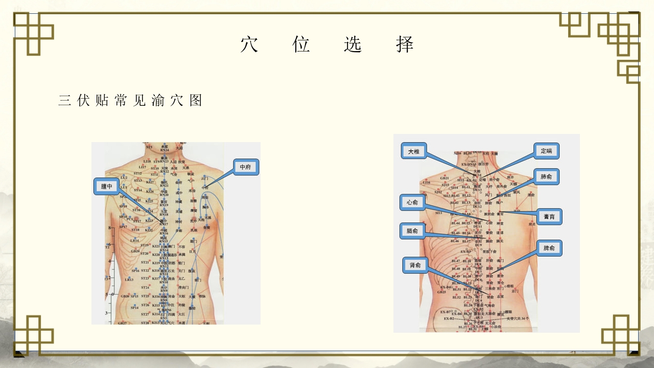 中医养生之道三伏贴敷操作与准备PPT培训课件-压缩14