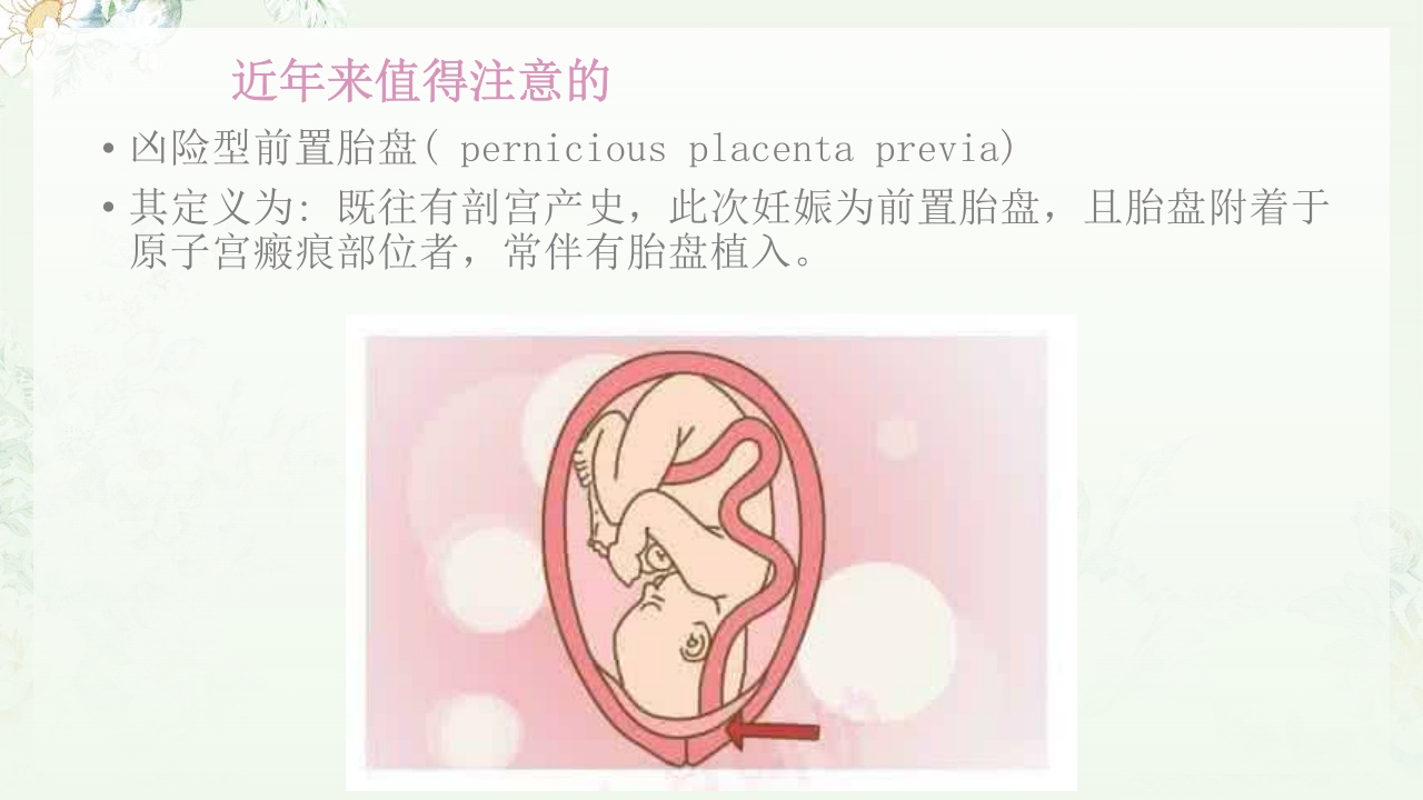 (妇产科)产后出血护理查房PPT课件13