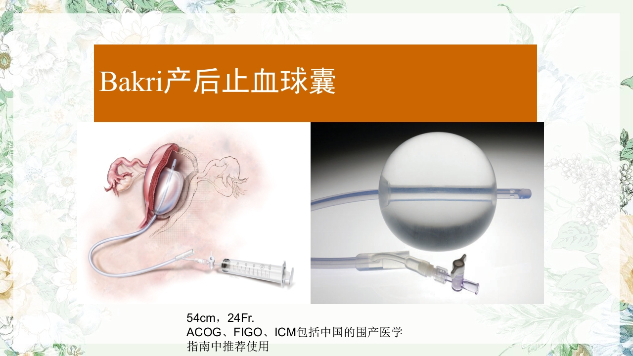 (妇产科)产后出血护理查房PPT课件28