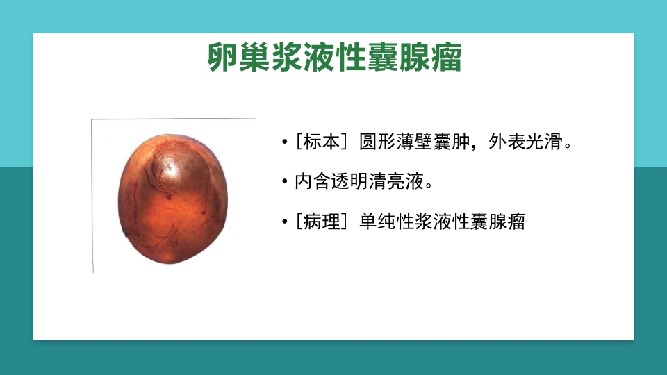 卵巢肿瘤护理查房卵巢癌护理查房PPT课件35