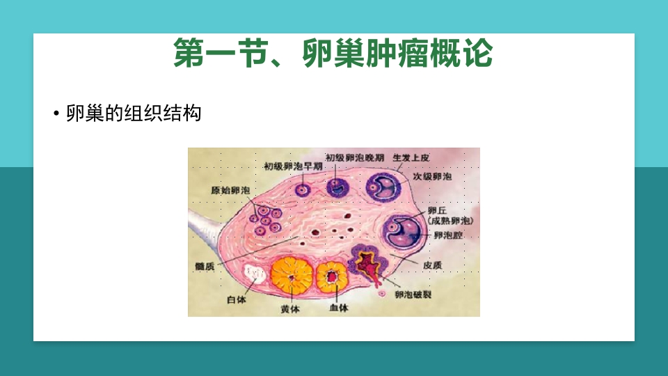 卵巢肿瘤护理查房卵巢癌护理查房PPT课件4