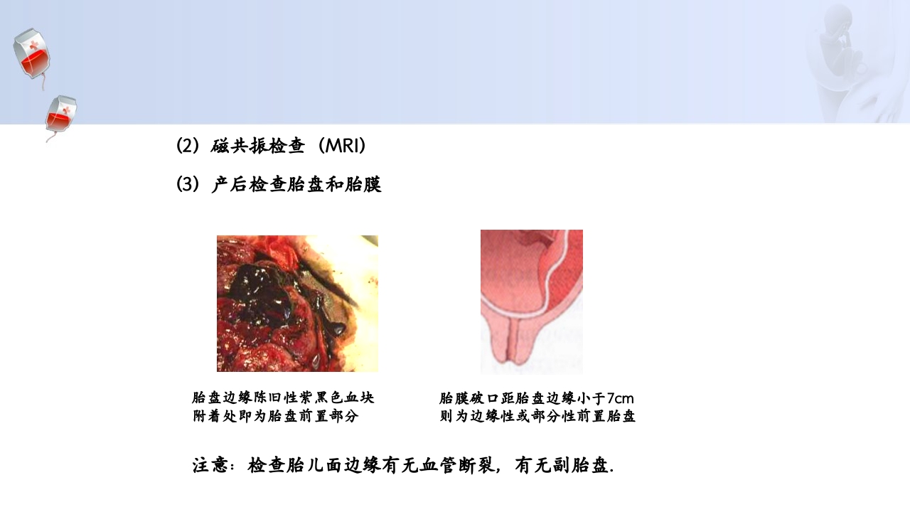 1例介入联合子宫全切救治产后大出血病人的病情讨论PPT21