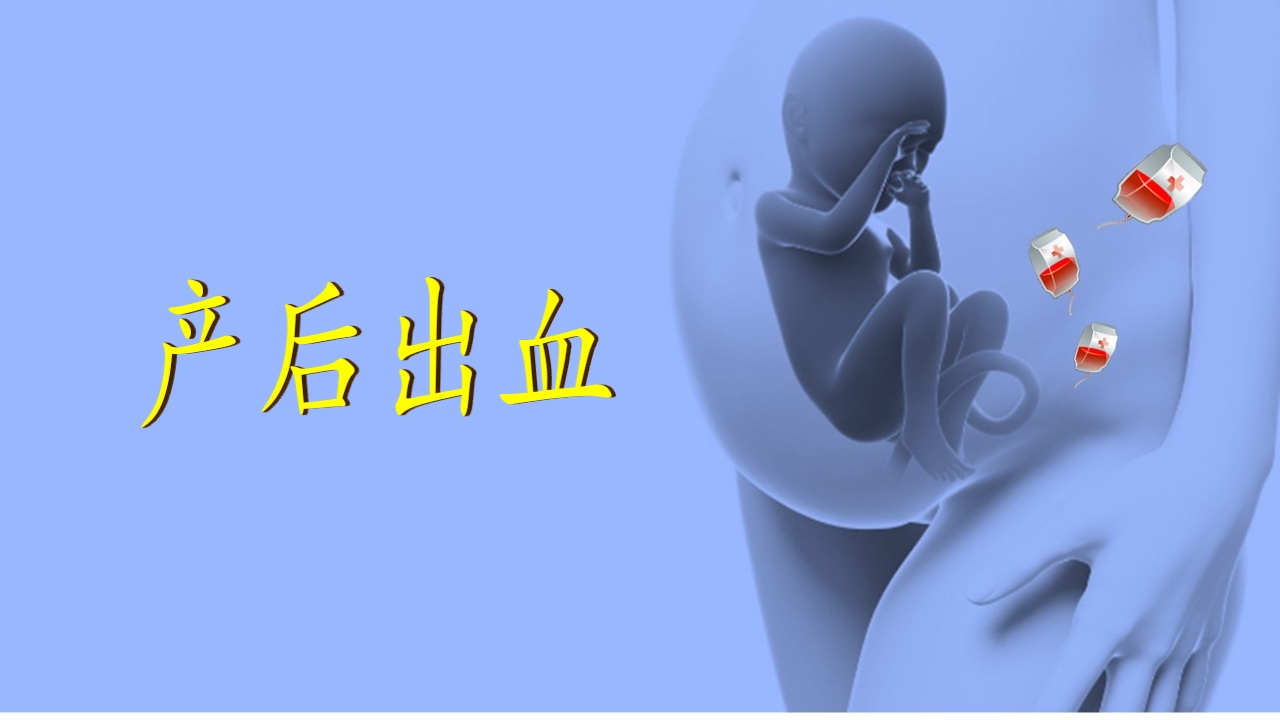 1例介入联合子宫全切救治产后大出血病人的病情讨论PPT27