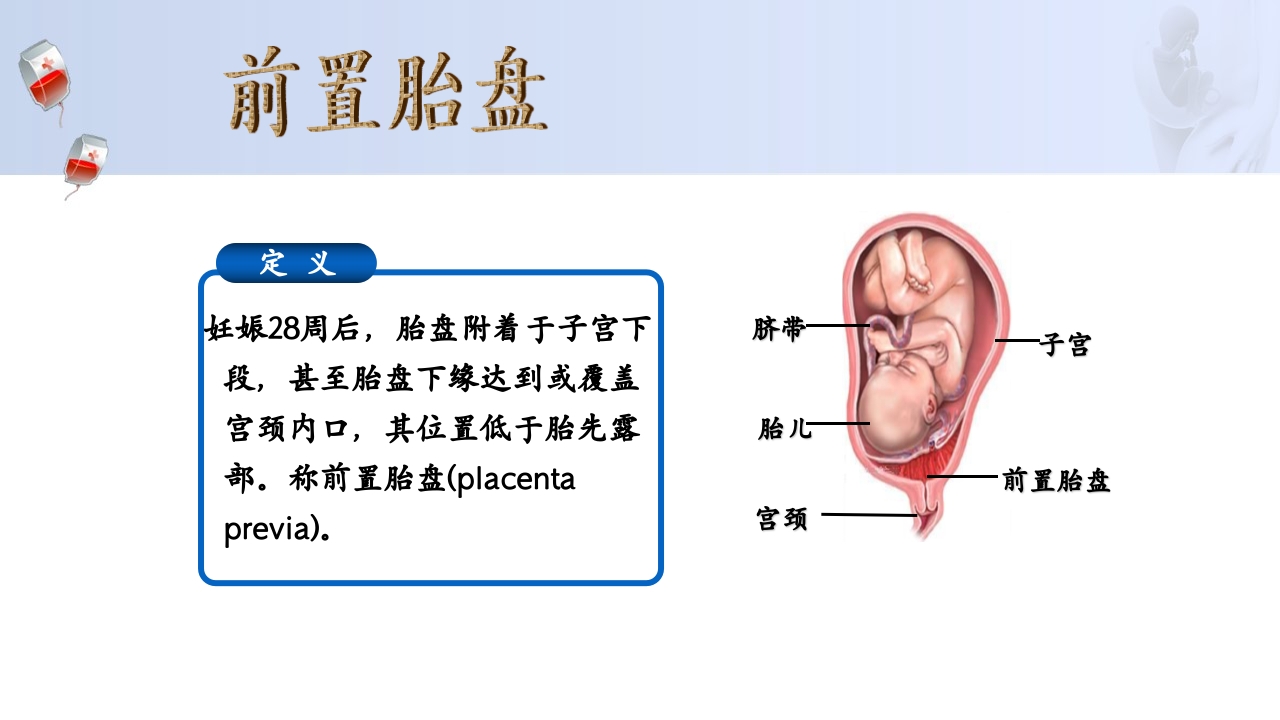 1例介入联合子宫全切救治产后大出血病人的病情讨论PPT8