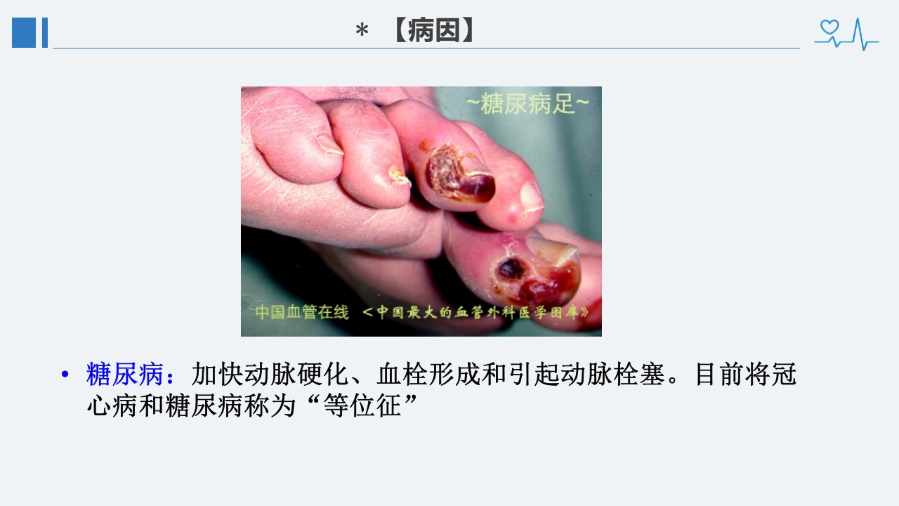 冠心病诊断治疗护理PPT课件11