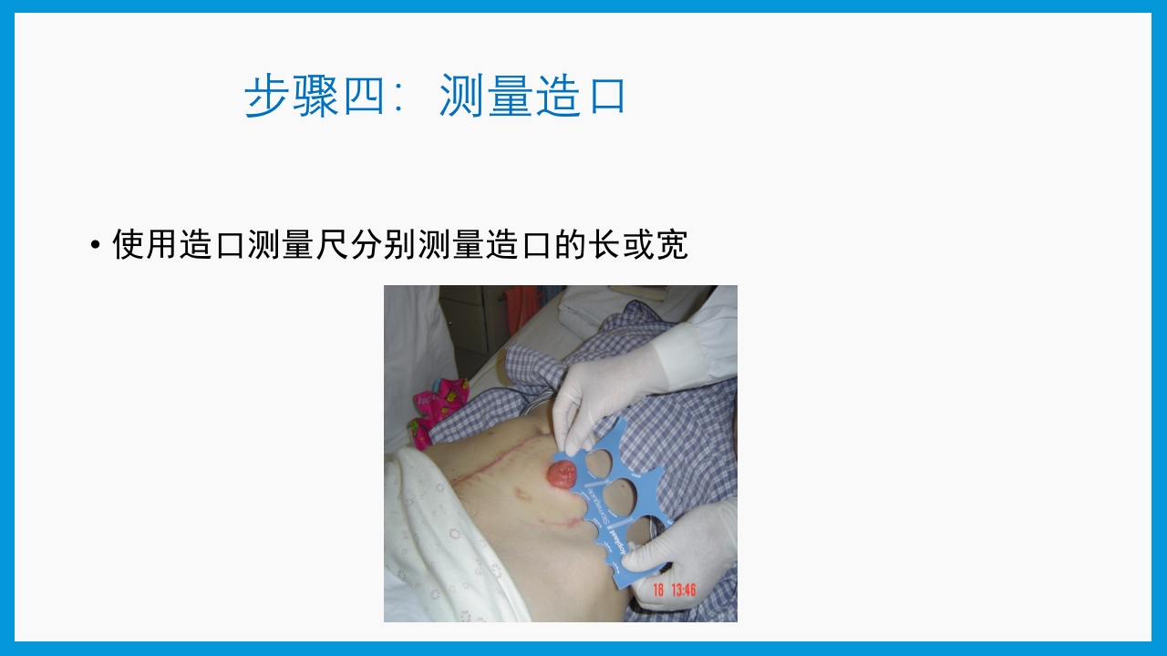 造口护理健康宣教PPT课件12